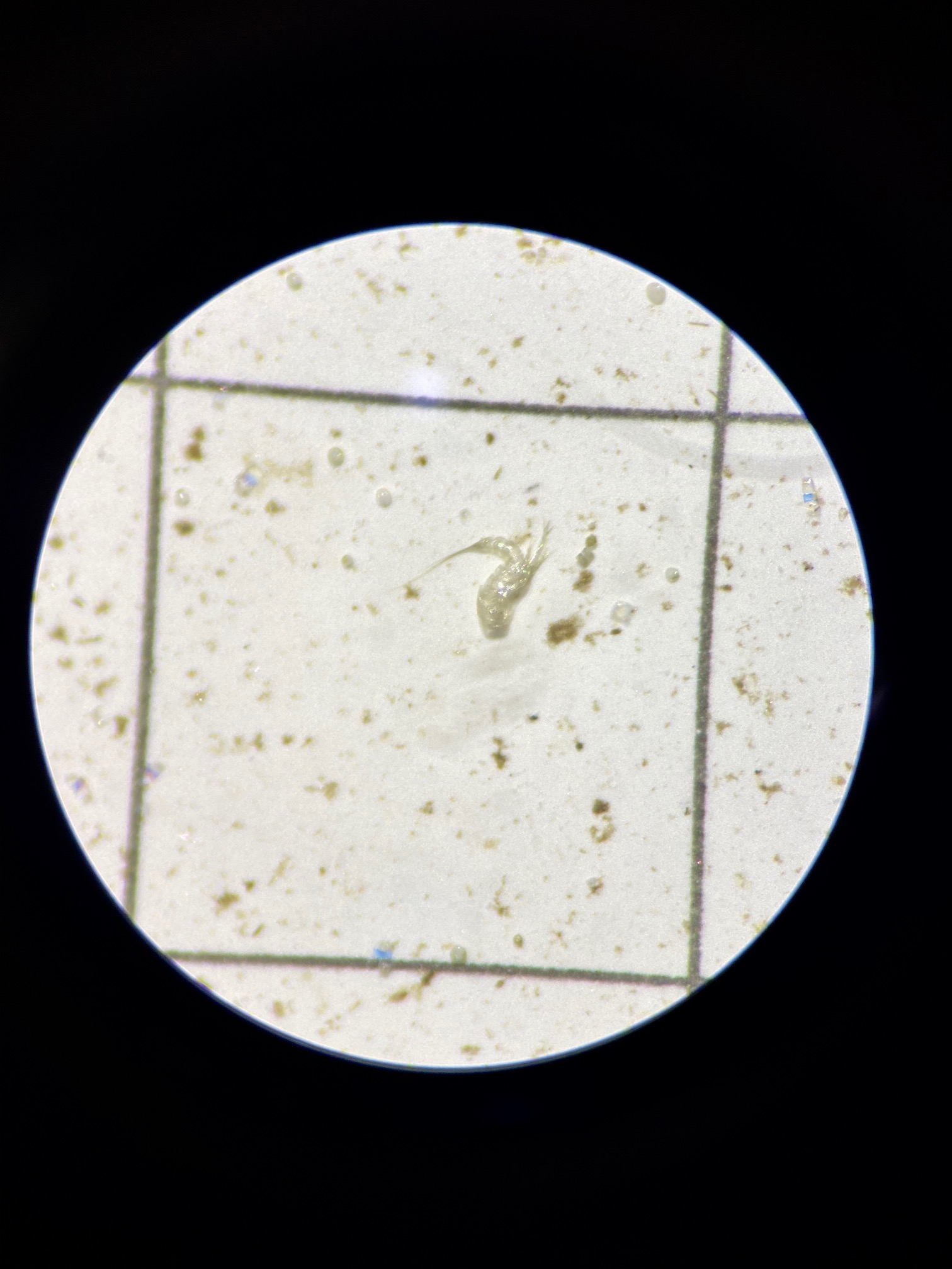 Microplastics%202.jpg